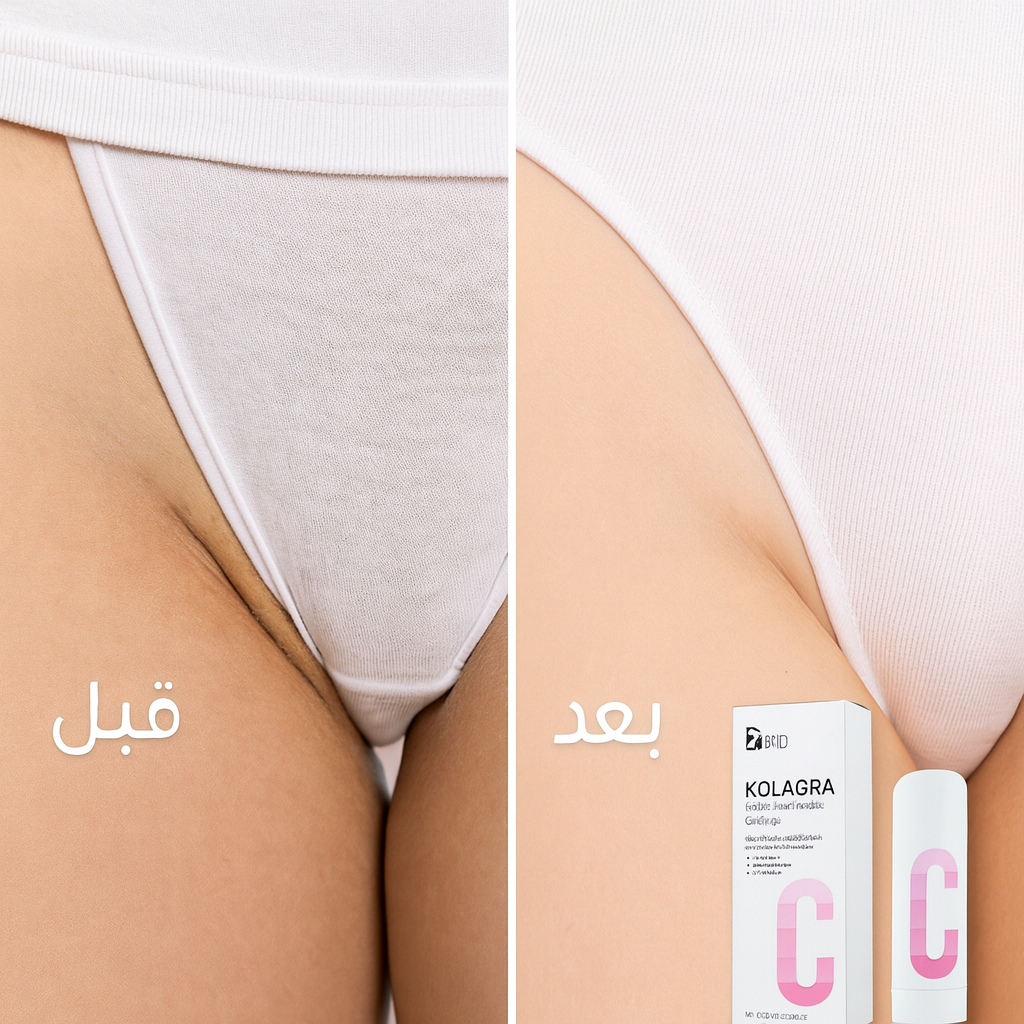 كريم كولاجرا لتفتيح المناطق الحساسة – Kolagra Bikini Whitening Cream